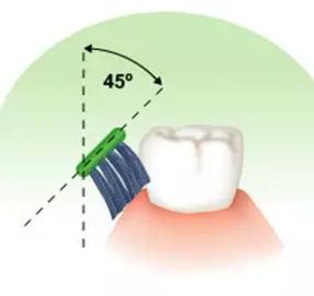 How to Protect Your Teeth